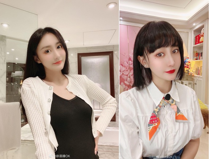 Hot girl nổi tiếng mạng xã hội cầu cứu dân mạng vì bị chồng bạo hành
