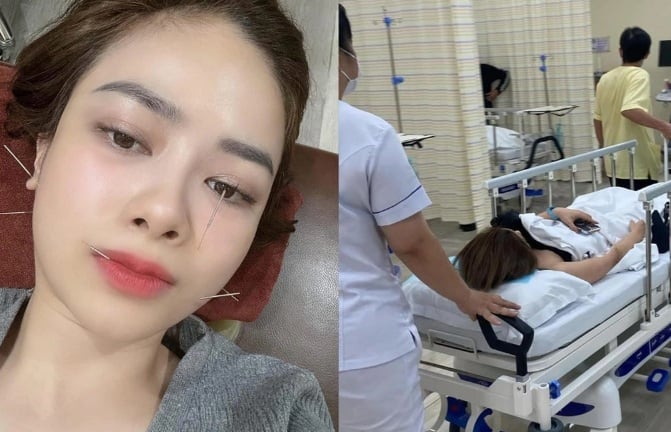 Một nữ ca sĩ Vbiz bị liệt dây thần kinh số 7, phải cấp cứu nửa đêm